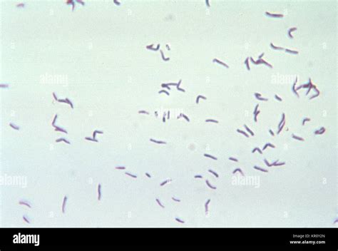 This micrograph depicts the gram-positive bacterium Eubacterium Stock ...