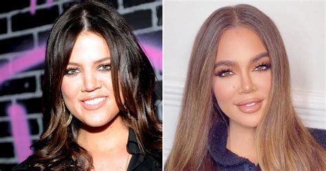 Did Khloe Kardashian Get Plastic Surgery? Experts Weigh In On Her ...