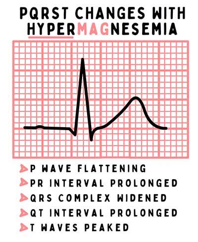 Hypermagnesemia causes, nursing assessment, and treatment | Health And ...