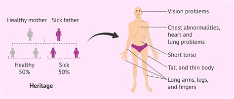 What is the Marfan syndrome?