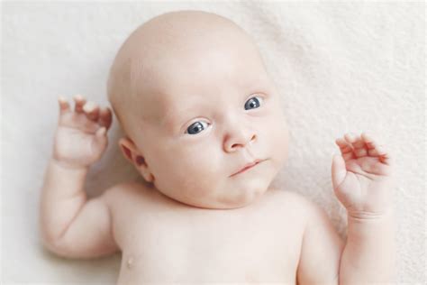 Torticollis - congenital wry neck | Physiotherapy News