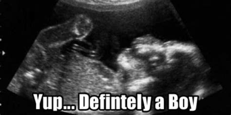 Funny Things Detected by Ultrasound (20 photos) | KLYKER.COM