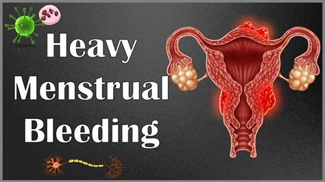 What Causes Heavy Menstrual Bleeding (Menorrhagia) |Causes Of Heavy Menstrual Bleeding - YouTube