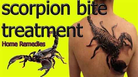 How To Get Rid Of Scorpions Naturally