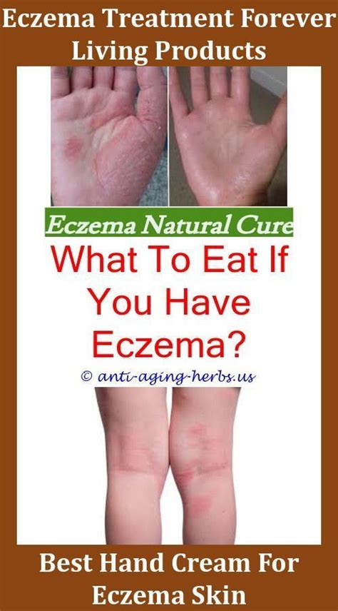 Dog Eczema Can Diet Affect Eczema Wet Eczema Eczema Patches On Toddler How To Get Rid Of Eczema ...