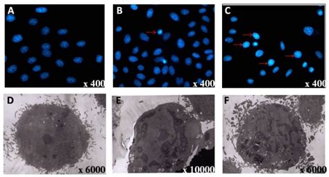 Chromatin condensation and nuclear fragmentation typical for apoptosis ...