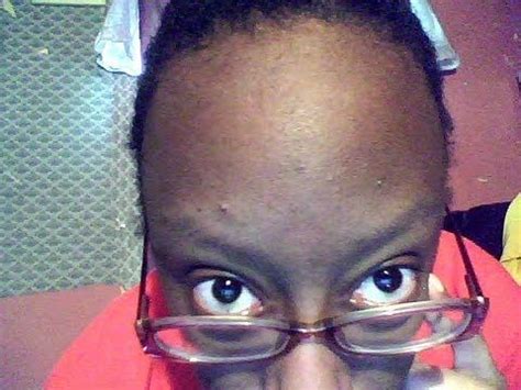 Black People With Big Foreheads