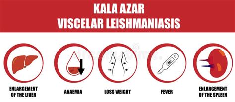 Kala Azar Symptoms. Viscelar Leishmaniasis Disease. Round Icon Stock ...