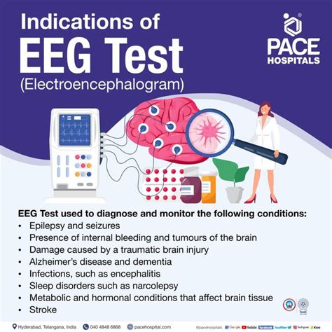 Can An Eeg Detect Past Seizures? Exploring The Possibilities