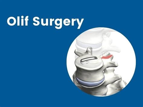 Olif Surgery in Mumbai at best price in Mumbai | ID: 25850194512