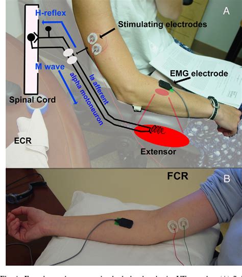 Figure 1 from Between-day reliability of upper extremity H-reflexes | Semantic Scholar