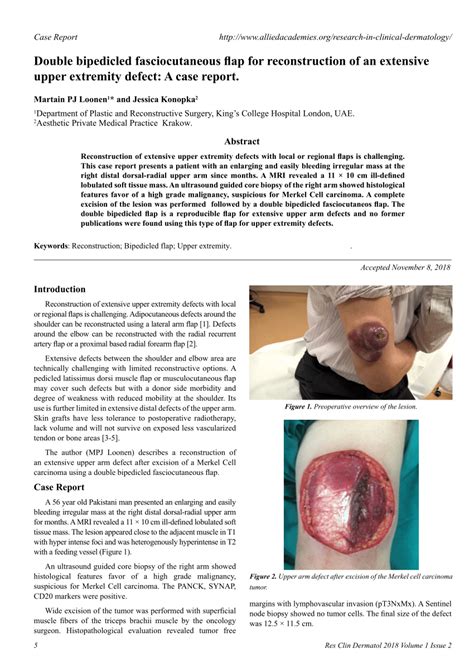 (PDF) Double bipedicled fasciocutaneous flap for reconstruction of an extensive upper extremity ...