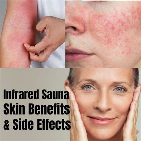 5 Infrared Sauna Skin Benefits + Side Effects