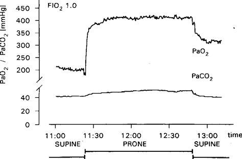 Ventilation-Perfusion Ratio | Semantic Scholar