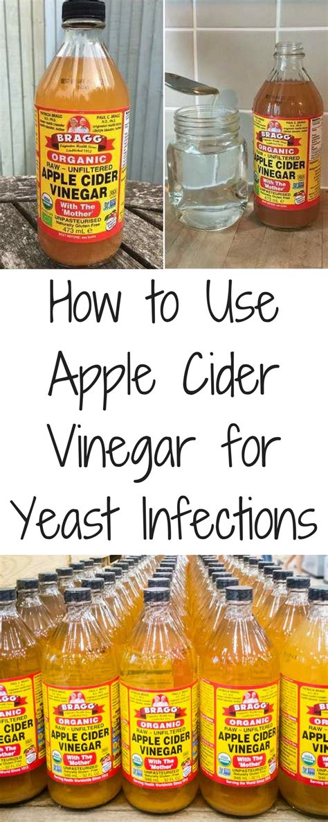 How to Use Apple Cider Vinegar for Yeast Infections #yeastinfection #candida | Yeast infection ...