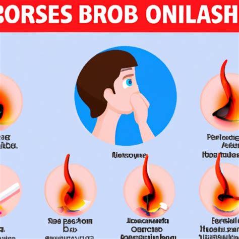 Why Is My Nose Burning: Causes, Remedies, and Lifestyle Changes - The ...