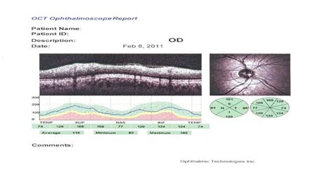 RNFL Analysis for Normal | Download Scientific Diagram