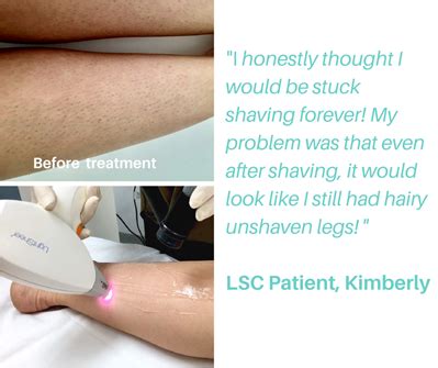 Laser Hair Removal Review - Laser Skin Care