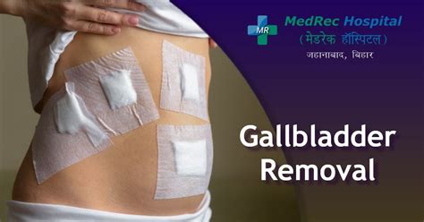 Gallbladder Removal Surgery : Everything You Need To Know