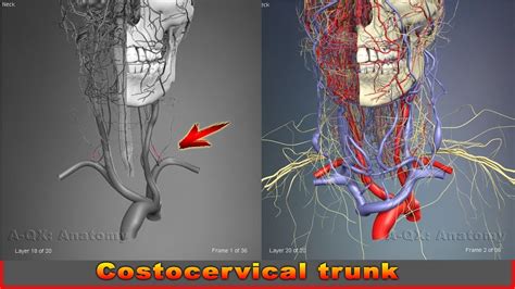 Costocervical trunk | Arteries of head and neck | 3D Human Anatomy ...