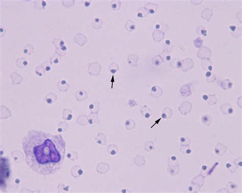 RBC morphology | eClinpath