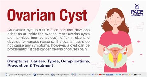 Ovarian cyst - Symptoms, Causes, Types, Complications & Treatment