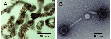 Microcystis aeruginosa and its cyanophage Ma-LMM01. (A) Optical... | Download Scientific Diagram