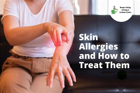 Skin Allergies and How to Treat Them