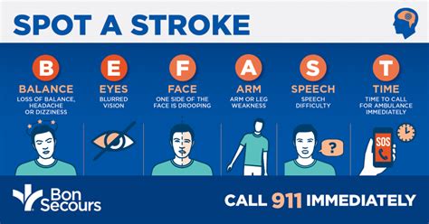 Stroke Symptoms Face