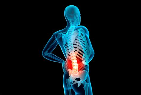 4 Most Common Causes for Lower Back Pain – One Simple Treatment