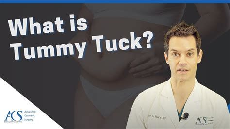 Tummy Tuck Surgery (Abdominoplasty): What it is, Best Candidates, and Result Expectations - YouTube