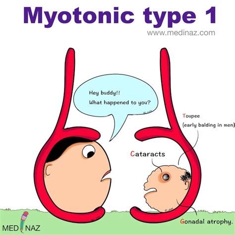 Myotonic dystrophy type 1 Mnemonic - Medinaz Blog