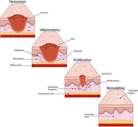 Wound healing and microbiome, an unexpected relationship - Canchy ...