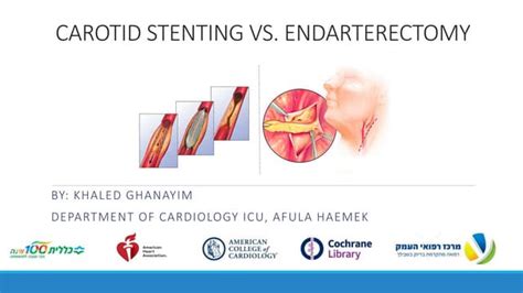 Carotid stenting vs. Endarterectomy - literature review | PPT