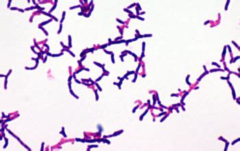 Actinomyces graevenitzii