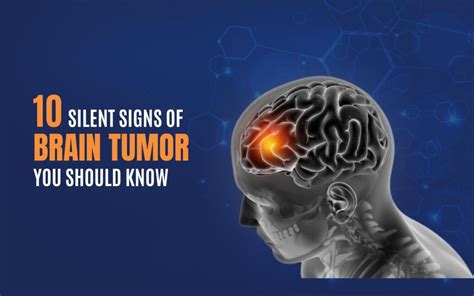 10 Silent Signs of Brain Tumor You Should Know - Wellness Hospitals