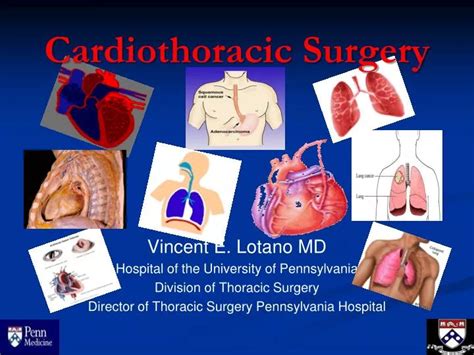 PPT - Cardiothoracic Surgery PowerPoint Presentation, free download ...