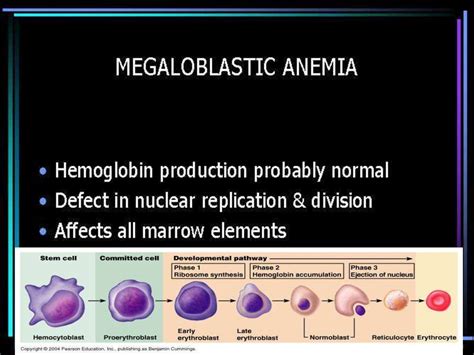 Megaloblastic anemia - презентация онлайн