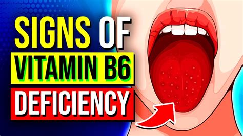 Vitamin B6 Deficiency, Pyridoxine Deficiency, Causes,