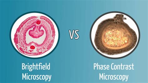 Brightfield vs Phase Contrast Microscopy: The Differences Explained ...