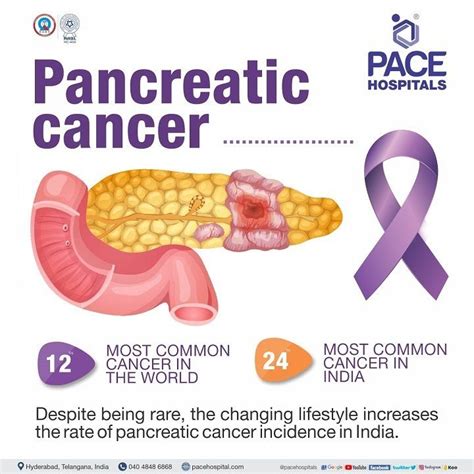 Pancreatic cancer - Symptoms, Causes, Complications & Prevention