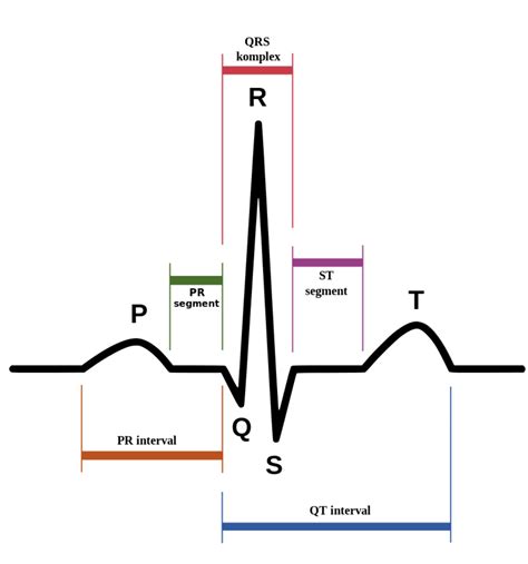 EKG Waveform