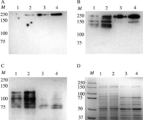 Western blot (A to C) and SDS-PAGE (D) analysis of P1 in wild-type S ...