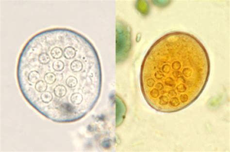 Entamoeba coli parasite | Medical Laboratories