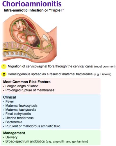 Chorioamnionitis: Causes, Symptoms, Diagnosis Treatment, 52% OFF