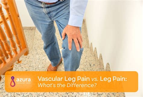 Vascular Leg Pain vs. Leg Pain: What's the Difference?