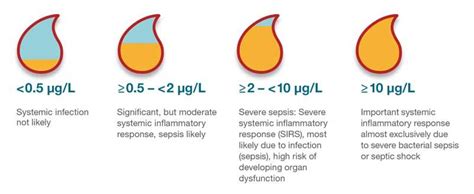 PCT reference ranges | Sepsis, Severe sepsis, Sepsis diagnosis