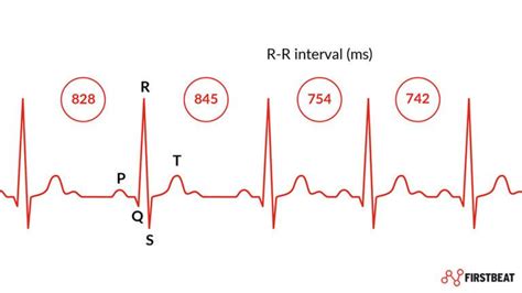 What is Heart Rate Variability (HRV) & why does it matter? | Firstbeat Blog