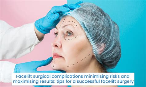 Facelift surgical complications minimising risks and maximising results ...