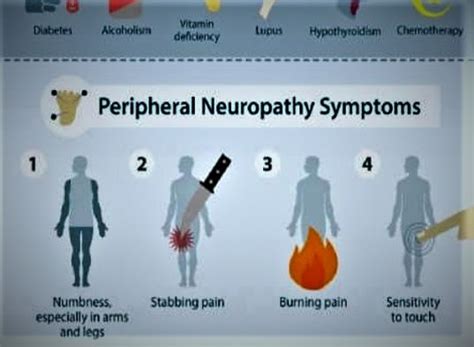 Polyneuropathy/Peripheral Neuropathy | Thesurvivordiva